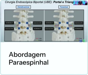 Módulos do curso EAD de endoscopia da coluna da Surg+.